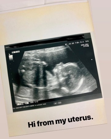 7B587699-A713-4C8B-B8DA-6D4B7A5F17D4